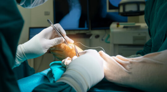 Chirurgie de l’hallux valgus